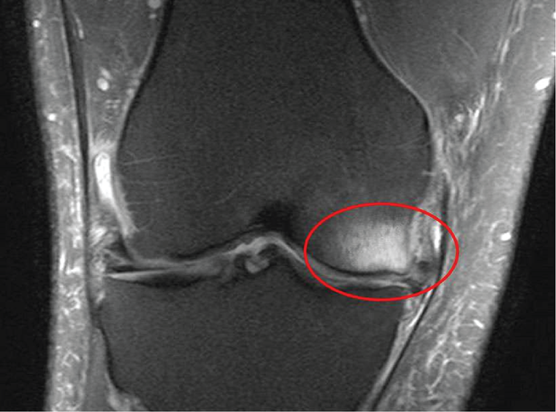 X-ray vs MRI diagnosis comparison