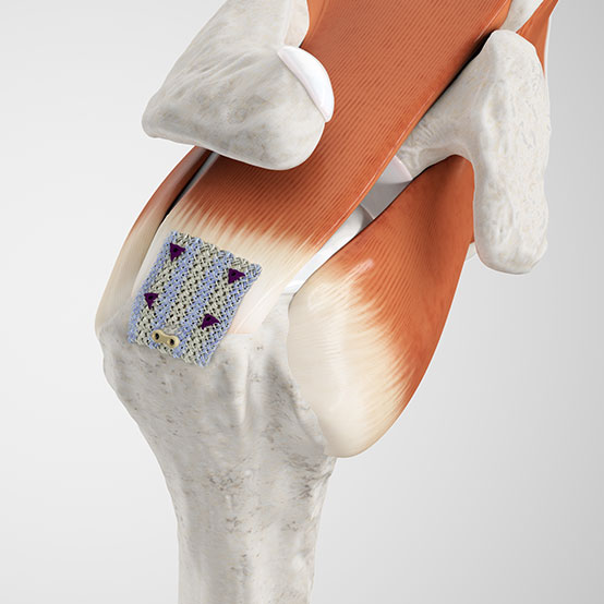 Rotator Cuff Tendon